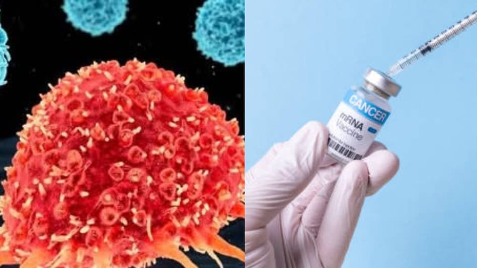 Russian Cancer Vaccine